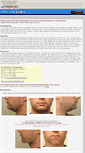 Mobile Screenshot of jawimplants.tripod.com